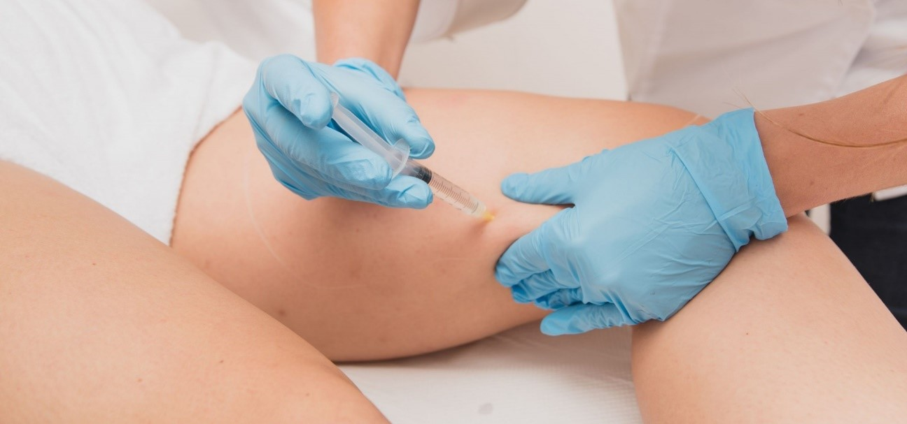Foto de uma escleroterapia com espuma